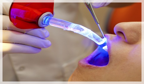 Periodontolojide lazer kullanımı